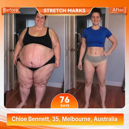 AU𝐎𝐟𝐟𝐢𝐜𝐢𝐚𝐥 𝐁𝐫𝐚𝐧𝐝 𝐒𝐭𝐨𝐫𝐞 🥇 𝑨𝑳𝑳𝒀𝑩𝑬𝑬® 𝟐𝟎𝟐𝟔 𝐌𝐨𝐫𝐢𝐧𝐠𝐚 & 𝐁𝐞𝐫𝐛𝐞𝐫𝐢𝐧𝐞 𝟒-𝐈𝐧-𝟏 𝐌𝐢𝐜𝐫𝐨-𝐏𝐚𝐫𝐭𝐢𝐜𝐥𝐞 𝐒𝐜𝐮𝐥𝐩𝐭𝐢𝐧𝐠 & 𝐅𝐚𝐭-𝐁𝐮𝐫𝐧 𝐒𝐡𝐨𝐫𝐭𝐬