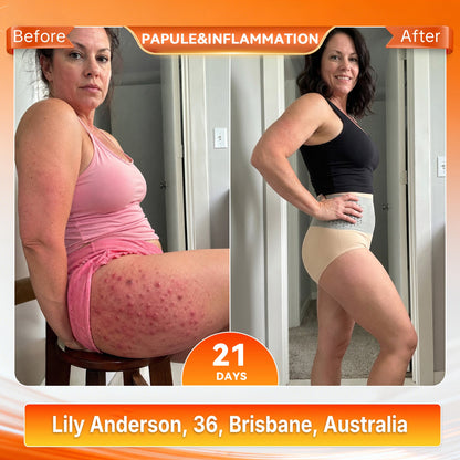 AU𝐎𝐟𝐟𝐢𝐜𝐢𝐚𝐥 𝐁𝐫𝐚𝐧𝐝 𝐒𝐭𝐨𝐫𝐞 🥇 𝑨𝑳𝑳𝒀𝑩𝑬𝑬® 𝟐𝟎𝟐𝟔 𝐌𝐨𝐫𝐢𝐧𝐠𝐚 & 𝐁𝐞𝐫𝐛𝐞𝐫𝐢𝐧𝐞 𝟒-𝐈𝐧-𝟏 𝐌𝐢𝐜𝐫𝐨-𝐏𝐚𝐫𝐭𝐢𝐜𝐥𝐞 𝐒𝐜𝐮𝐥𝐩𝐭𝐢𝐧𝐠 & 𝐅𝐚𝐭-𝐁𝐮𝐫𝐧 𝐒𝐡𝐨𝐫𝐭𝐬