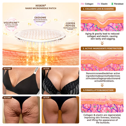 HISKIN® Bust Volume, Lift & Firming Nano Microneedle Patch Volufiline + Exosome + Copper Peptide Formula Powered by Cellular Renewal Technology